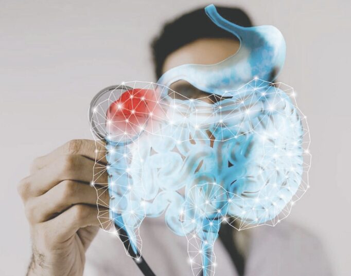 MyBIOME: La nueva frontera en la salud intestinal